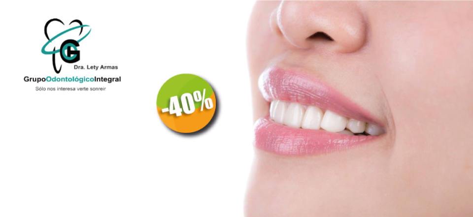 Grupo Odontológico Integral - $420 pesos instead of $700 por 1 Dental Cleaning with Ultrasound and Eliminate Tartar